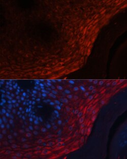 Invitrogen S100A8 Polyclonal Antibody 100 &mu;L; Unconjugated:Antibodies,