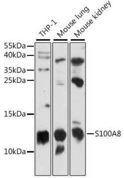 Invitrogen S100A8 Polyclonal Antibody 100 &mu;L; Unconjugated:Antibodies,