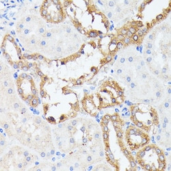 Invitrogen PTP4A2 Polyclonal Antibody 100 &mu;L; Unconjugated:Antibodies,