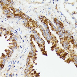 Invitrogen PTP4A2 Polyclonal Antibody 100 &mu;L; Unconjugated:Antibodies,