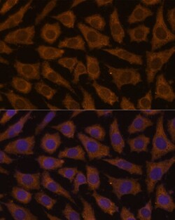 Invitrogen MTMR4 Polyclonal Antibody 100 &mu;L; Unconjugated:Antibodies,