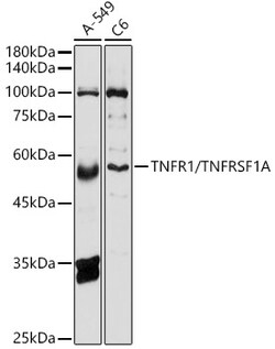 Invitrogen TNFR1 Polyclonal Antibody 100 &mu;L; Unconjugated:Antibodies,