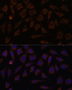 VILL Polyclonal Antibody, Invitrogen&trade;