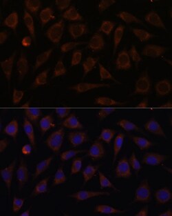 VILL Polyclonal Antibody, Invitrogen&trade;