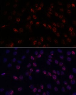 DDX24 Polyclonal Antibody 100 &mu;L | Buy Online | Invitrogen | Fisher Scientific
