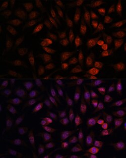 DDX24 Polyclonal Antibody 100 &mu;L | Buy Online | Invitrogen | Fisher Scientific