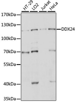 DDX24 Polyclonal Antibody 100 &mu;L | Buy Online | Invitrogen | Fisher Scientific