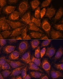 Invitrogen MRPS14 Polyclonal Antibody 100 &mu;L; Unconjugated:Antibodies,
