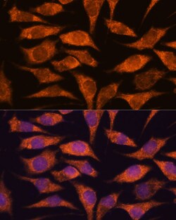 Invitrogen MRPS14 Polyclonal Antibody 100 &mu;L; Unconjugated:Antibodies,