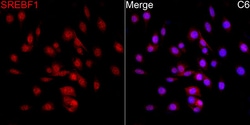 Invitrogen SREBP1 Polyclonal Antibody 100 &mu;L; Unconjugated:Antibodies,