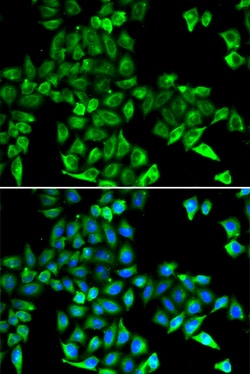 Invitrogen Cystatin C Polyclonal Antibody 100 μL; Unconjugated:Antibodies,