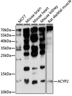 Invitrogen ACYP2 Polyclonal Antibody 100 &mu;L; Unconjugated:Antibodies,