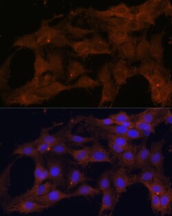 Invitrogen BAX Polyclonal Antibody 100 &mu;L; Unconjugated:Antibodies,