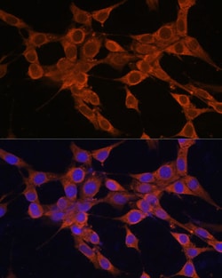 Invitrogen BAX Polyclonal Antibody 100 &mu;L; Unconjugated:Antibodies,