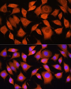 Invitrogen BAX Polyclonal Antibody 100 &mu;L; Unconjugated:Antibodies,