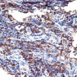 Invitrogen BAX Polyclonal Antibody 100 &mu;L; Unconjugated:Antibodies,