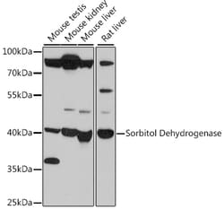 Invitrogen Sorbitol Dehydrogenase Polyclonal Antibody 100 &mu;L; Unconjugated:Antibodies,