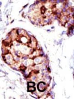Invitrogen TSG101 Polyclonal Antibody 400 &mu;L; Unconjugated:Antibodies,