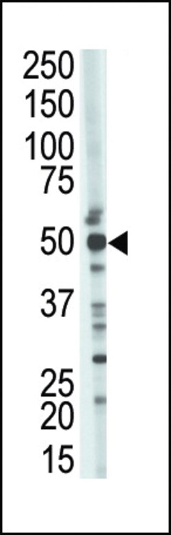 Invitrogen TSG101 Polyclonal Antibody 400 &mu;L; Unconjugated:Antibodies,