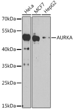 Invitrogen Aurora A Polyclonal Antibody 100 &mu;L; Unconjugated:Antibodies,