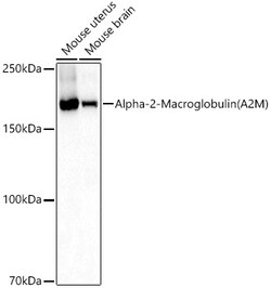 Invitrogen A2M Polyclonal Antibody 100 &mu;L | Buy Online | Invitrogen&trade; | Fisher Scientific