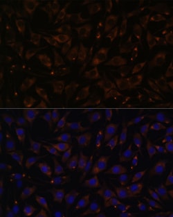 Invitrogen PLLP Polyclonal Antibody 100 &mu;L; Unconjugated:Antibodies,