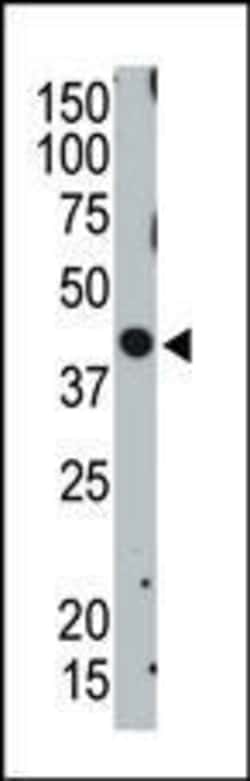 Invitrogen TSG101 Polyclonal Antibody 400 &mu;L; Unconjugated:Antibodies,
