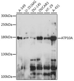 Invitrogen ATP10A Polyclonal Antibody 100 &mu;L; Unconjugated:Antibodies,