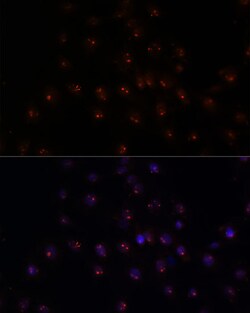 Invitrogen METT10D Polyclonal Antibody 100 &mu;L; Unconjugated:Antibodies,