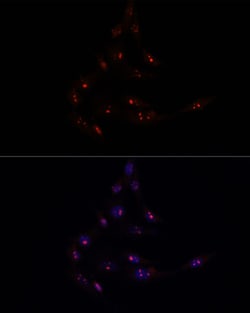 Invitrogen METT10D Polyclonal Antibody 100 &mu;L; Unconjugated:Antibodies,