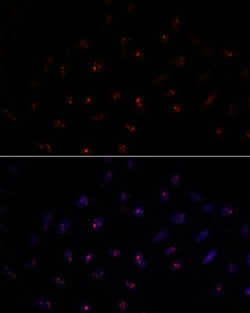Invitrogen METT10D Polyclonal Antibody 100 &mu;L; Unconjugated:Antibodies,
