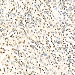 Invitrogen METT10D Polyclonal Antibody 100 &mu;L; Unconjugated:Antibodies,