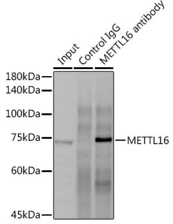 Invitrogen METT10D Polyclonal Antibody 100 &mu;L; Unconjugated:Antibodies,