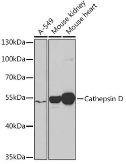 Cathepsin D Polyclonal Antibody:Antibodies, Polyclonal