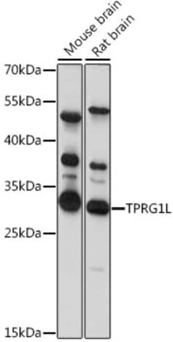 Invitrogen TPRG1L Polyclonal Antibody 100 &mu;L; Unconjugated:Antibodies,