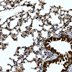 Invitrogen ZNF384 Polyclonal Antibody 100 &mu;L; Unconjugated:Antibodies,