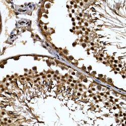 Invitrogen ZNF384 Polyclonal Antibody 100 &mu;L; Unconjugated:Antibodies,