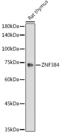 Invitrogen ZNF384 Polyclonal Antibody 100 &mu;L; Unconjugated:Antibodies,
