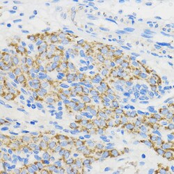 Invitrogen BOLA3 Polyclonal Antibody 100 &mu;L; Unconjugated:Antibodies,