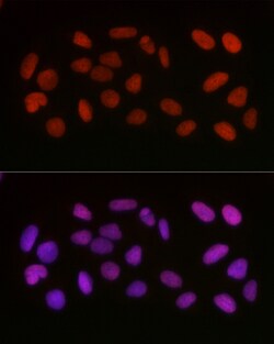 Invitrogen Acetyl-HMGB1 (Lys29) Polyclonal Antibody 100 &mu;L; Unconjugated:Antibodies,