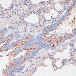 Invitrogen ZNRF3 Polyclonal Antibody 100 &mu;L; Unconjugated:Antibodies,