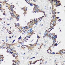 Cyclin B1 Polyclonal Antibody 100 &mu;L | Buy Online | Invitrogen | Fisher Scientific