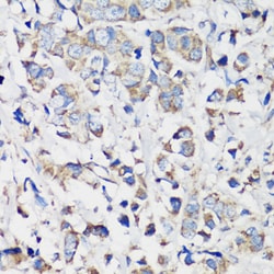 Cyclin B1 Polyclonal Antibody 100 &mu;L | Buy Online | Invitrogen | Fisher Scientific