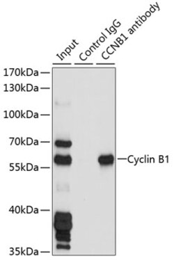 Cyclin B1 Polyclonal Antibody 100 &mu;L | Buy Online | Invitrogen | Fisher Scientific