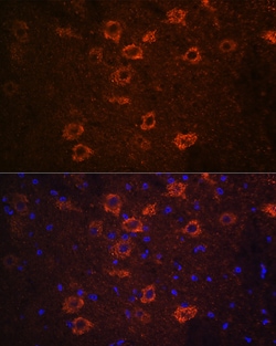 Invitrogen VAChT Polyclonal Antibody 100 &mu;L; Unconjugated:Antibodies,