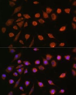 MCU Polyclonal Antibody, Invitrogen 100 &mu;L; Unconjugated:Antibodies,