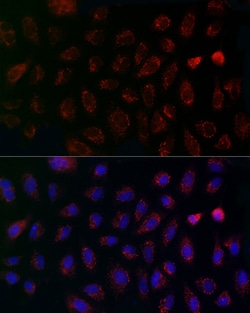 MCU Polyclonal Antibody, Invitrogen 100 &mu;L; Unconjugated:Antibodies,