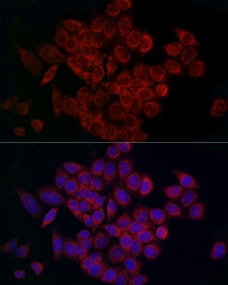 MCU Polyclonal Antibody, Invitrogen 100 &mu;L; Unconjugated:Antibodies,
