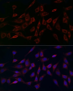 MCU Polyclonal Antibody, Invitrogen 100 &mu;L; Unconjugated:Antibodies,
