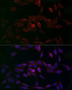 MCU Polyclonal Antibody, Invitrogen 100 &mu;L; Unconjugated:Antibodies,